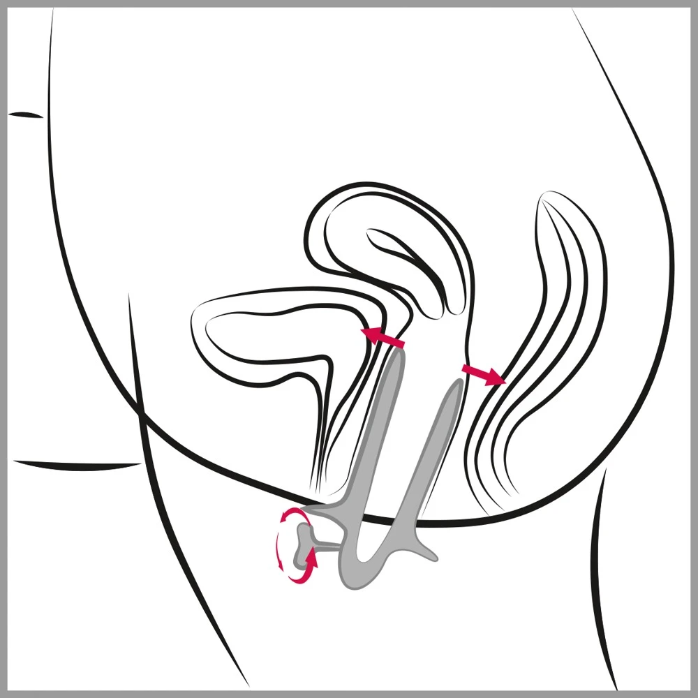 Vaginalspekulum